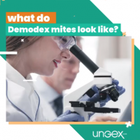 âœ… what do Demodex mites look like?